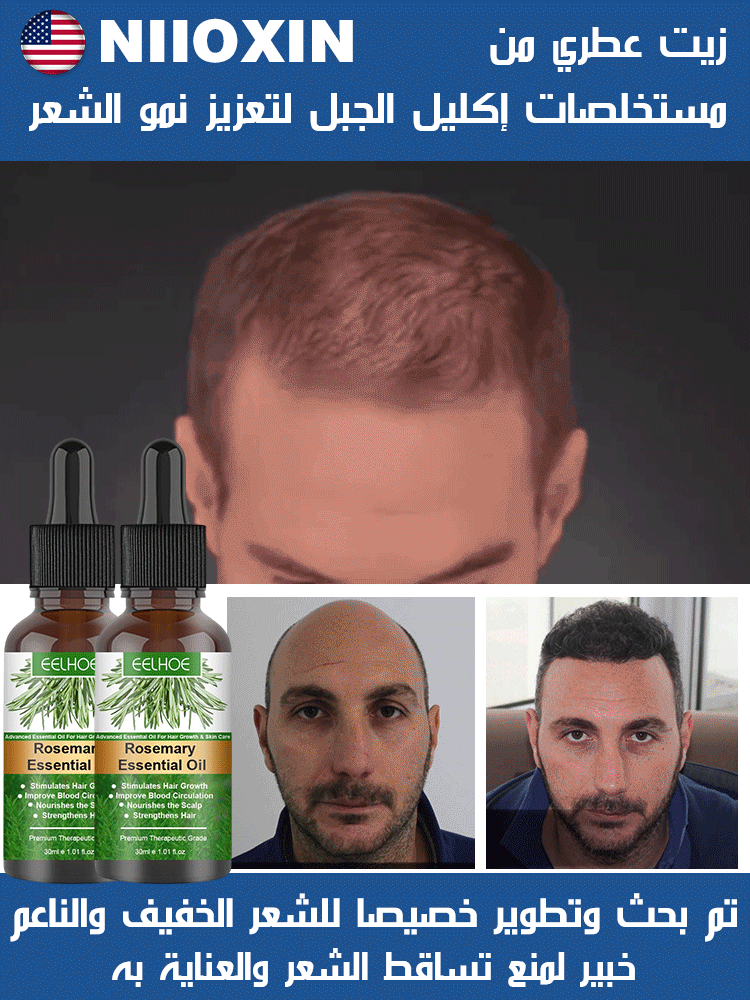 زيت عطري من  مستخلصات إكليل  الجبل لتعزيز نمو الشعر