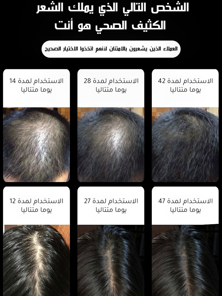 زيت عطري من  مستخلصات إكليل  الجبل لتعزيز نمو الشعر