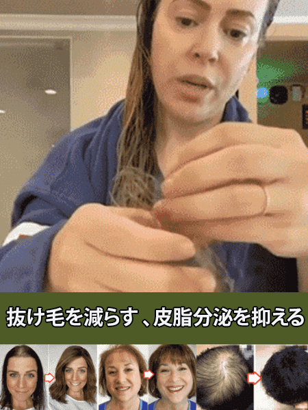 ジンジャーエキス抜け毛防止育毛促進シャンプー