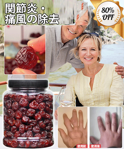 [関節炎・痛風の除去] 高品質ドライチェリー