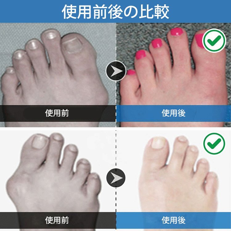 男女兼用矯正用5本指浅履きソックス