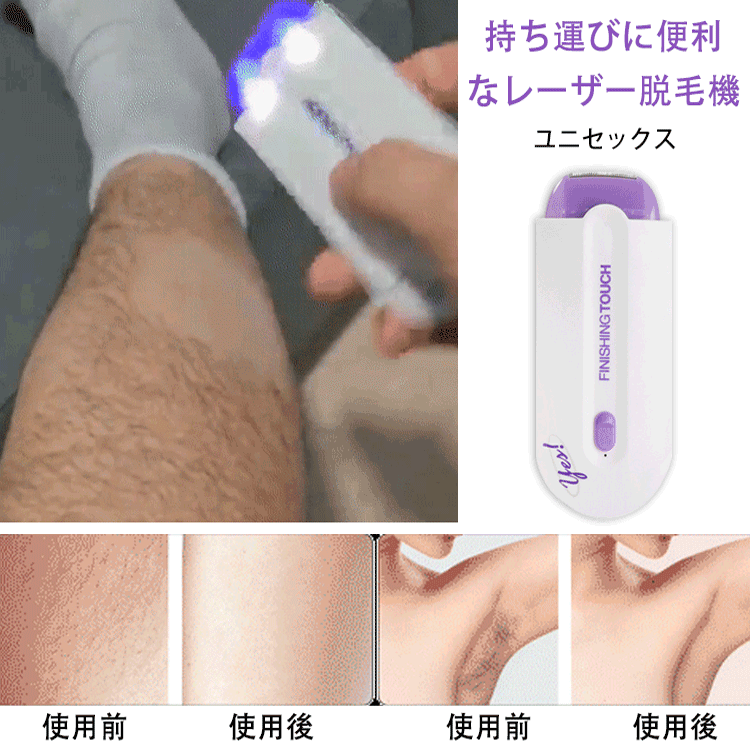 ユニセックス レーザー脱毛機