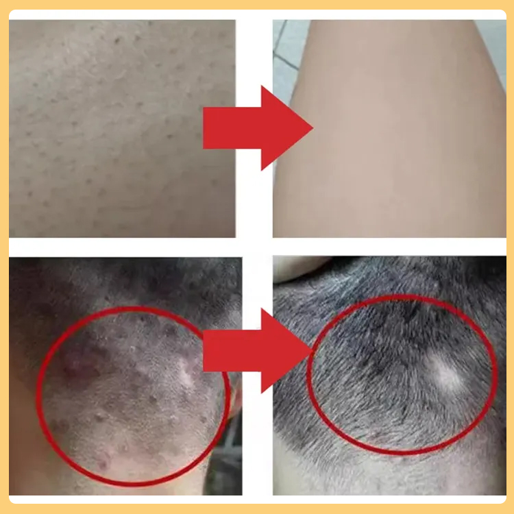 [Efficiently solves itchy back and itchy head] Sulfur Mite Removing Shower Gel