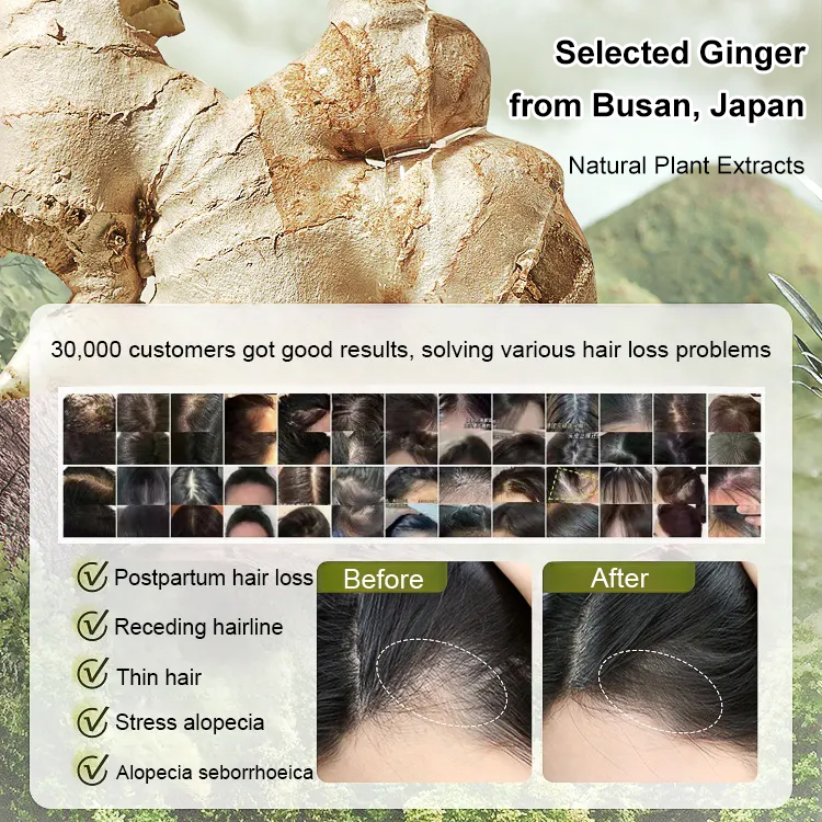 Hot Sale Ginger Plant Extract Anti-Hair Loss Hair Shampoo