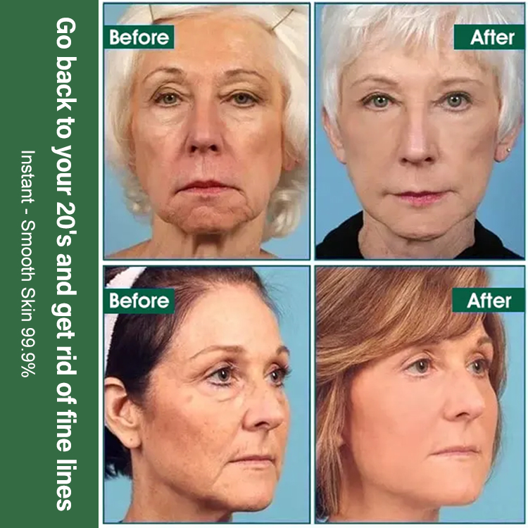 Green Bottle Lifting & Firming Serum