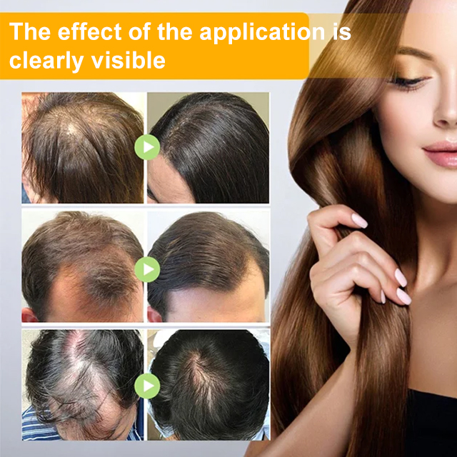 Biotin Hair Growth Spray