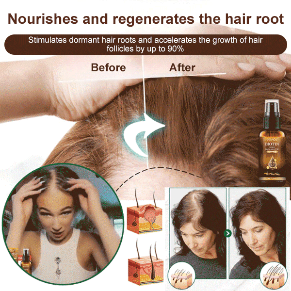Biotin Hair Growth Spray