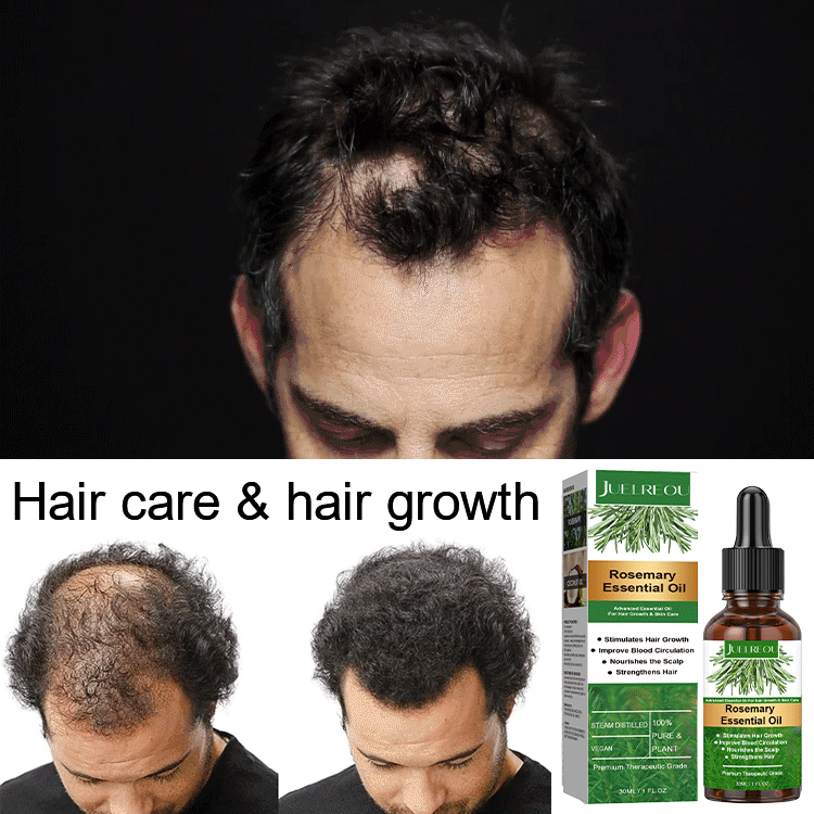 Rosemary Hair Growth Essential Oil