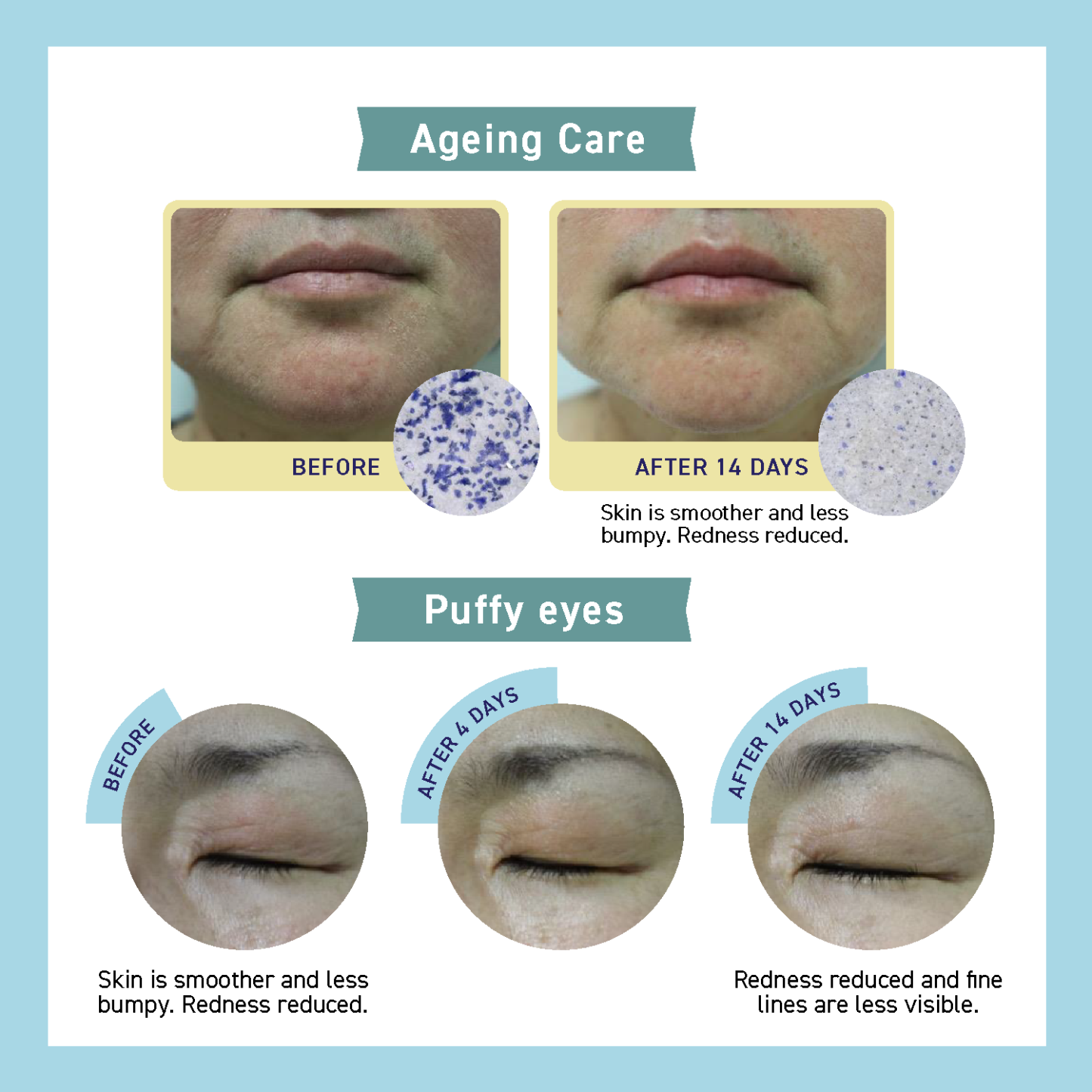 SKIN BARRIER CREAM (65g)