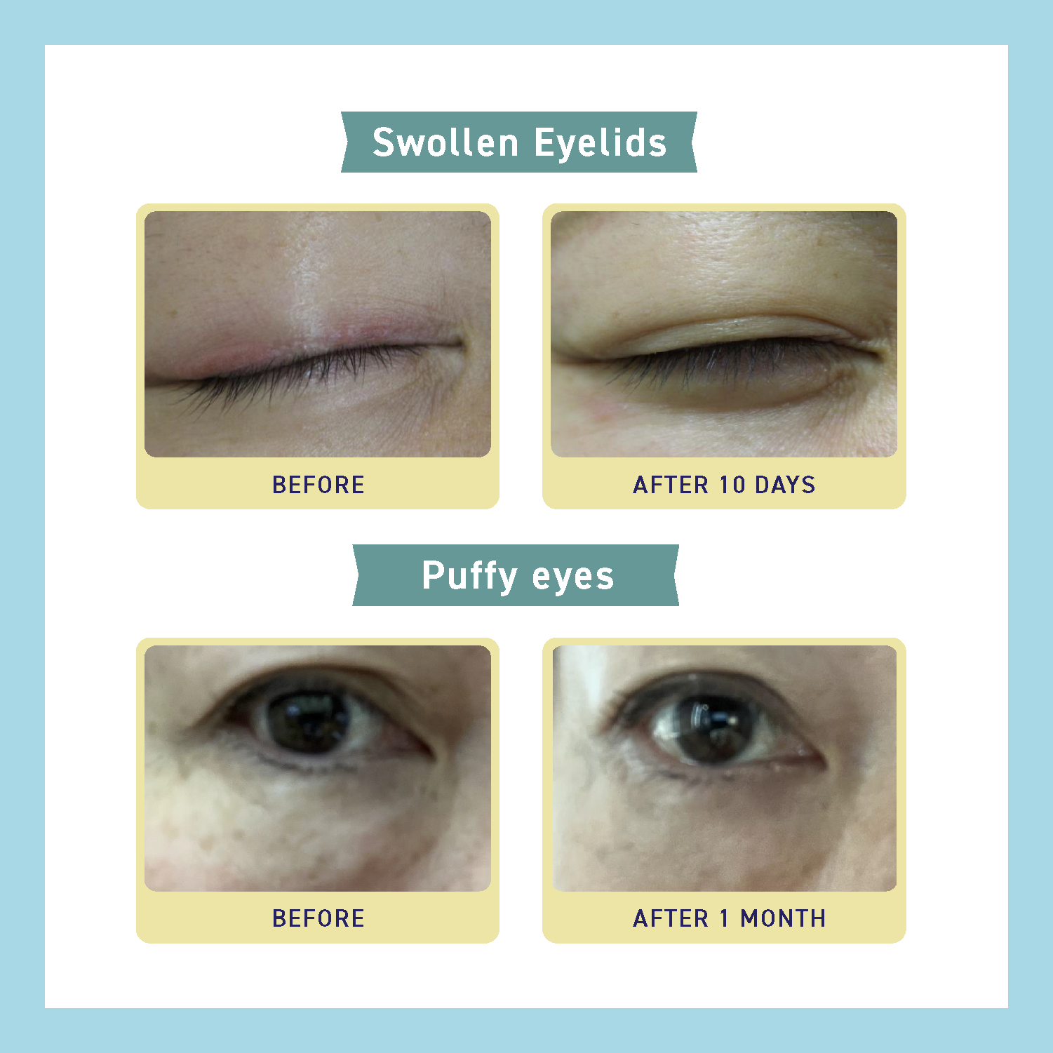 SKIN BARRIER EYE ZONE