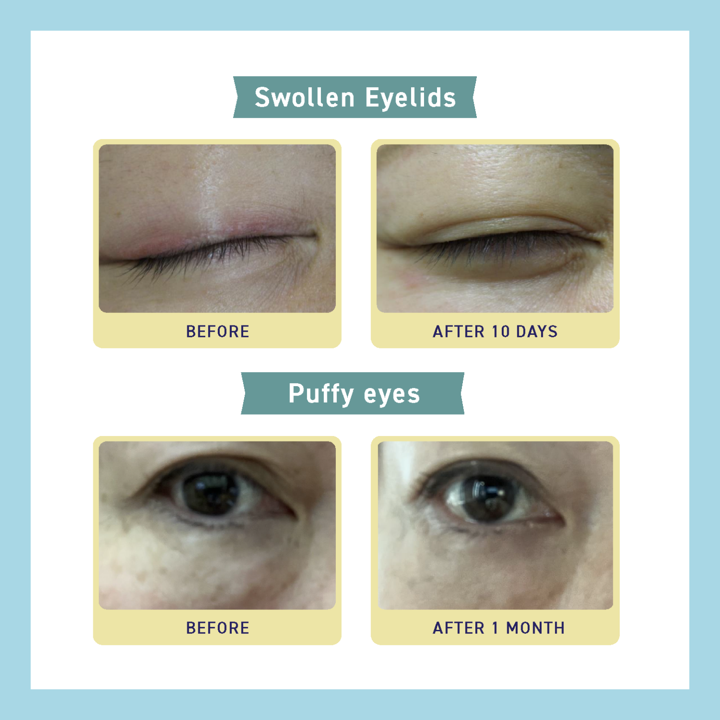 SKIN BARRIER EYE ZONE