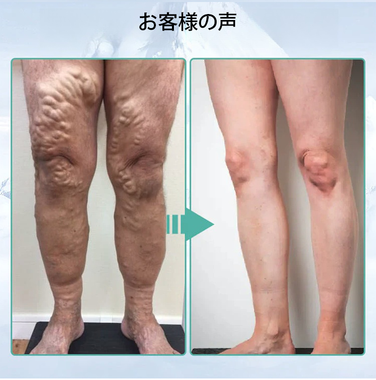 JP-1150946-HFH-冰丝护理鞋垫-秦丹1_06.png