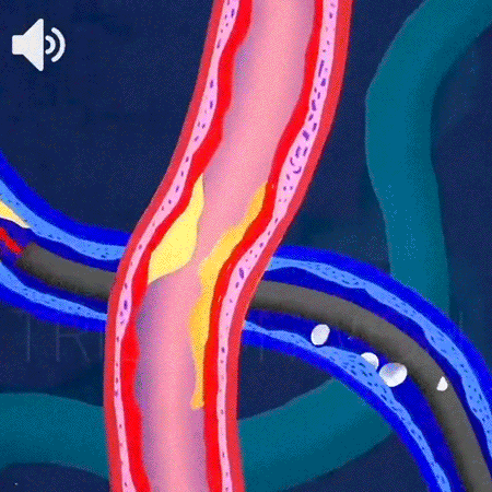 手环_15.gif