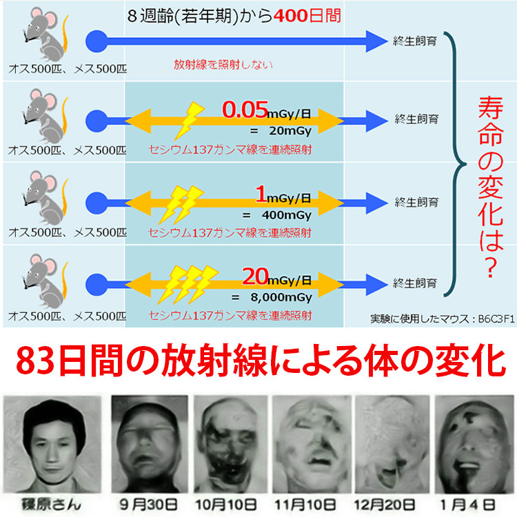 放射線防護ブレスレット
