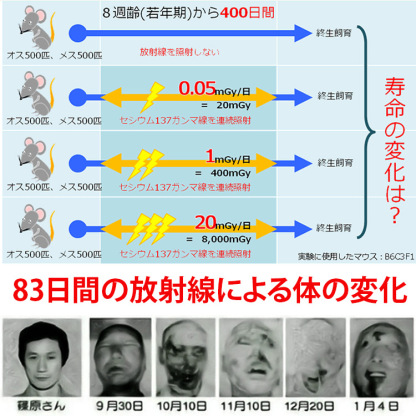 放射線防護ブレスレット