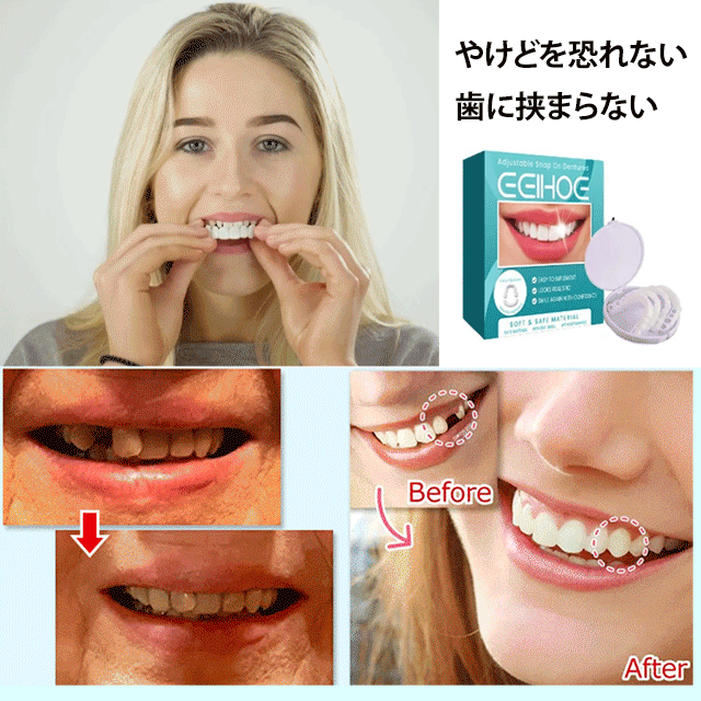 調節可能なつけ歯