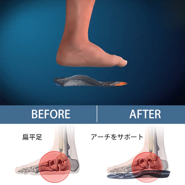 扁平足インソール