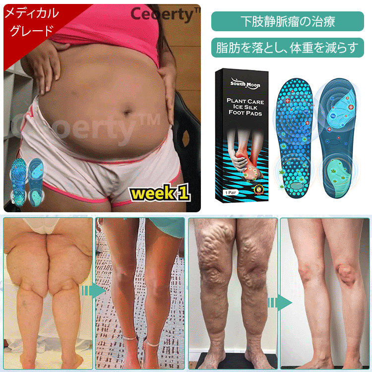 アイスシルク医療用インソール