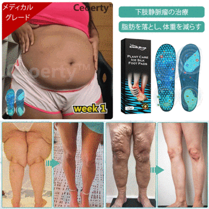 アイスシルク医療用インソール
