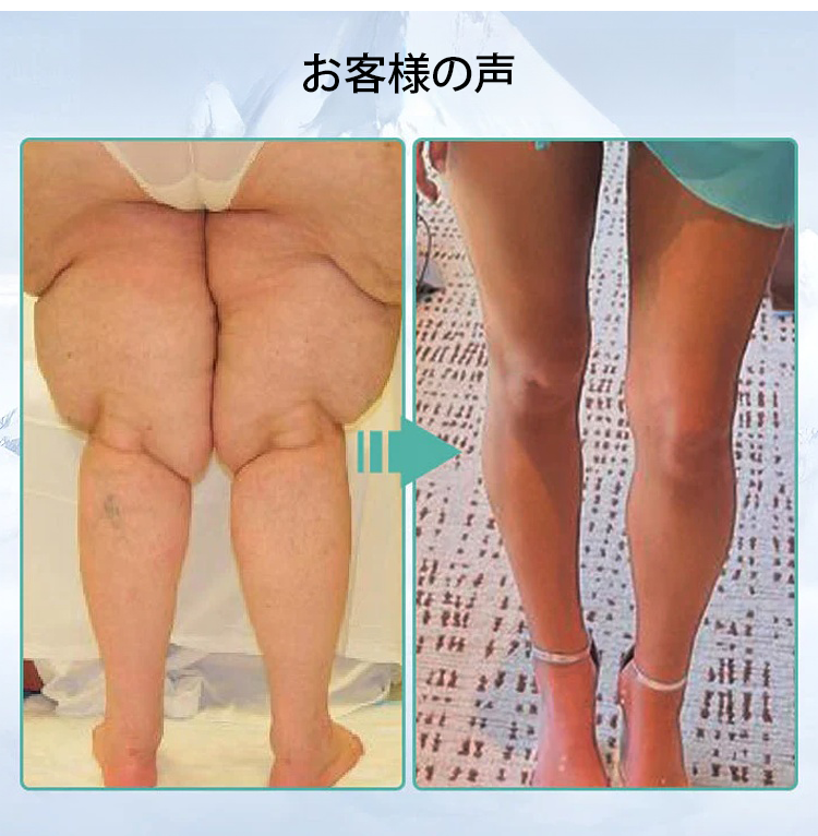 JP-1150946-HFH-冰丝护理鞋垫-秦丹1_05.png