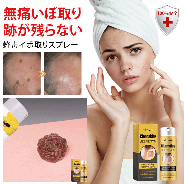 蜂毒成分配合イボ取りスプレー