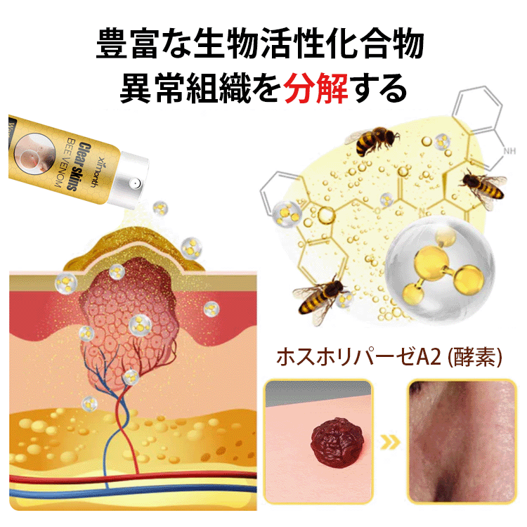 蜂毒成分配合イボ取りスプレー