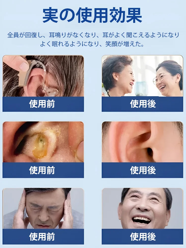 耳鳴り緩和スプレー