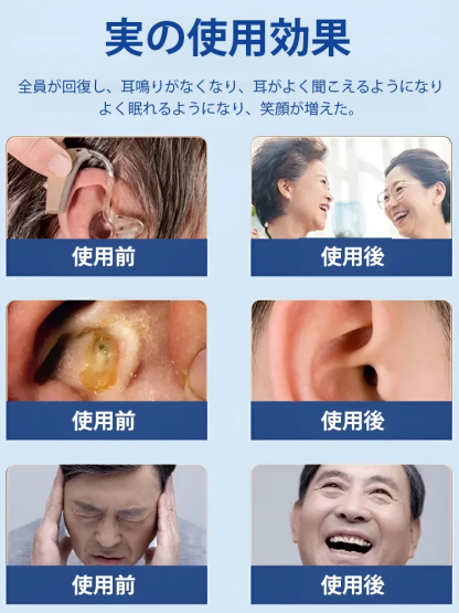 耳鳴り緩和スプレー