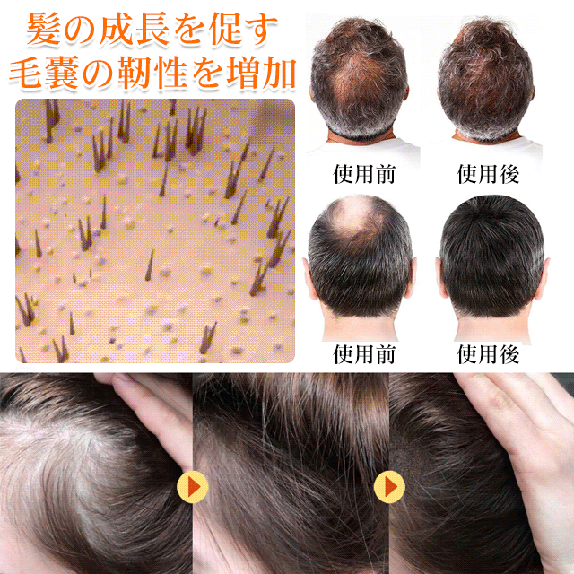 ビオチン育毛スプレー