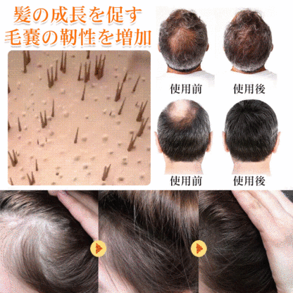 ビオチン育毛スプレー