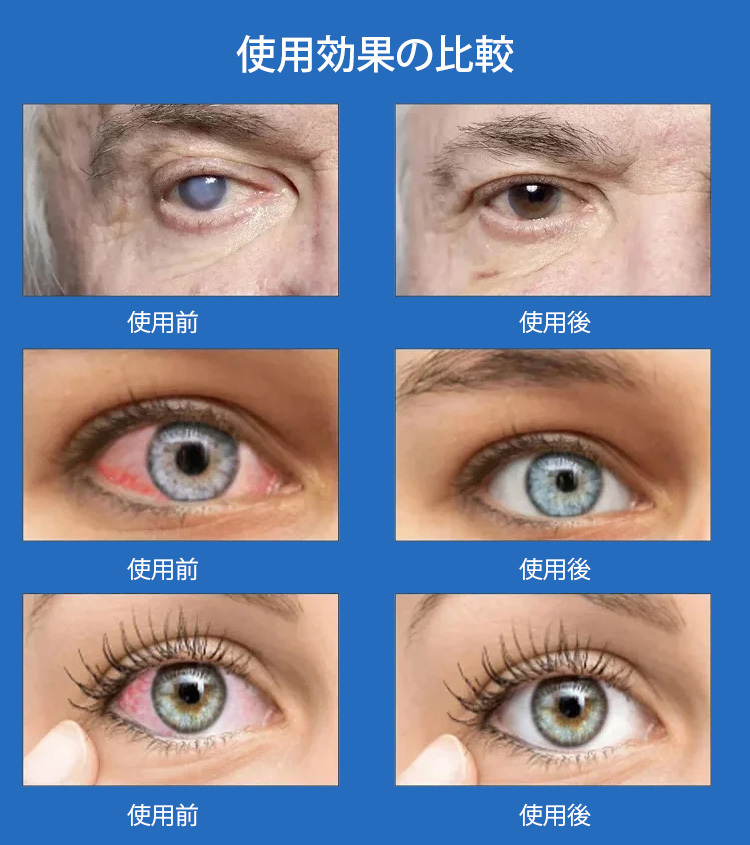 視力保護&疲労回復の目薬