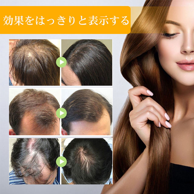 ビオチン育毛スプレー
