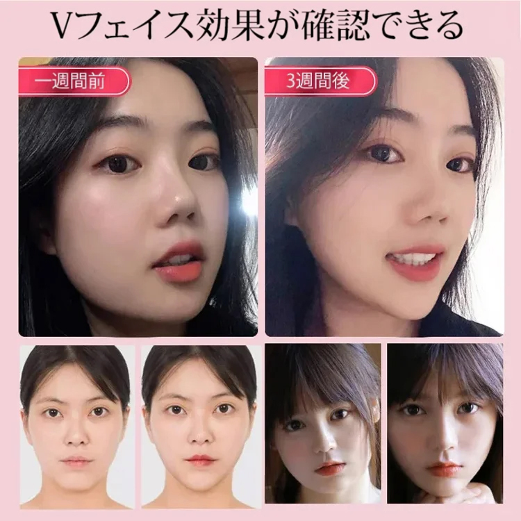 小顔効果V顔美顔器