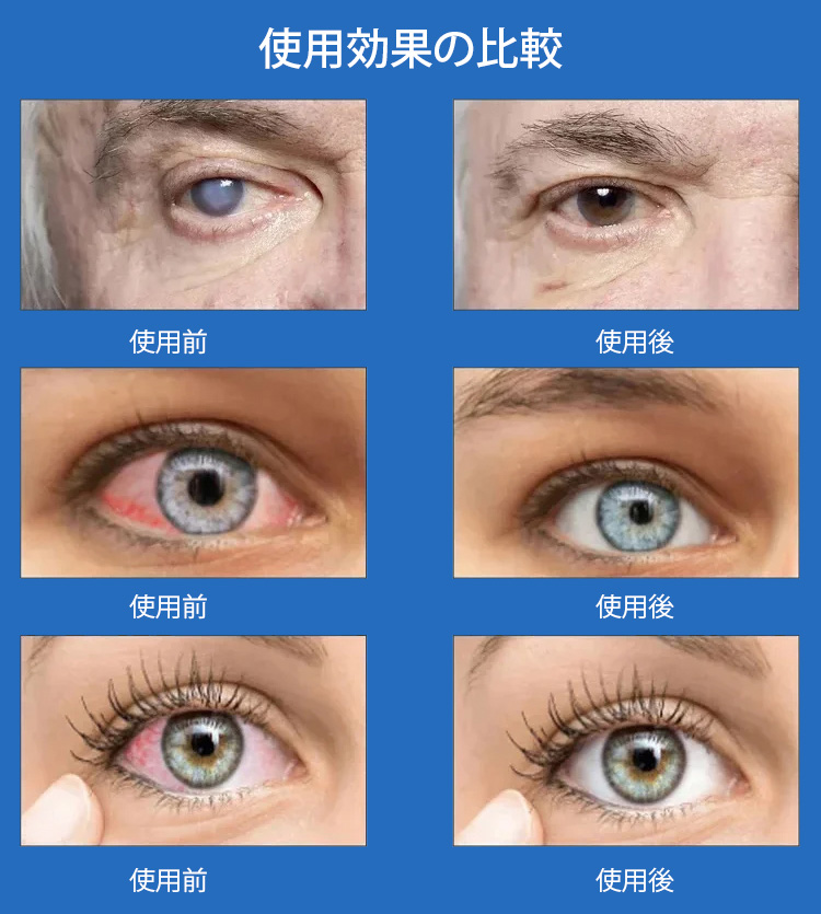 翻译件-SL-保护视力缓疲护理滴眼液-1153601_13.jpg