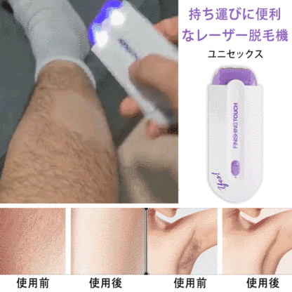 ユニセックス   レーザー脱毛機