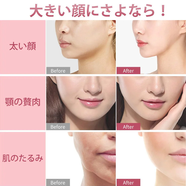 小顔リフトアップベルト