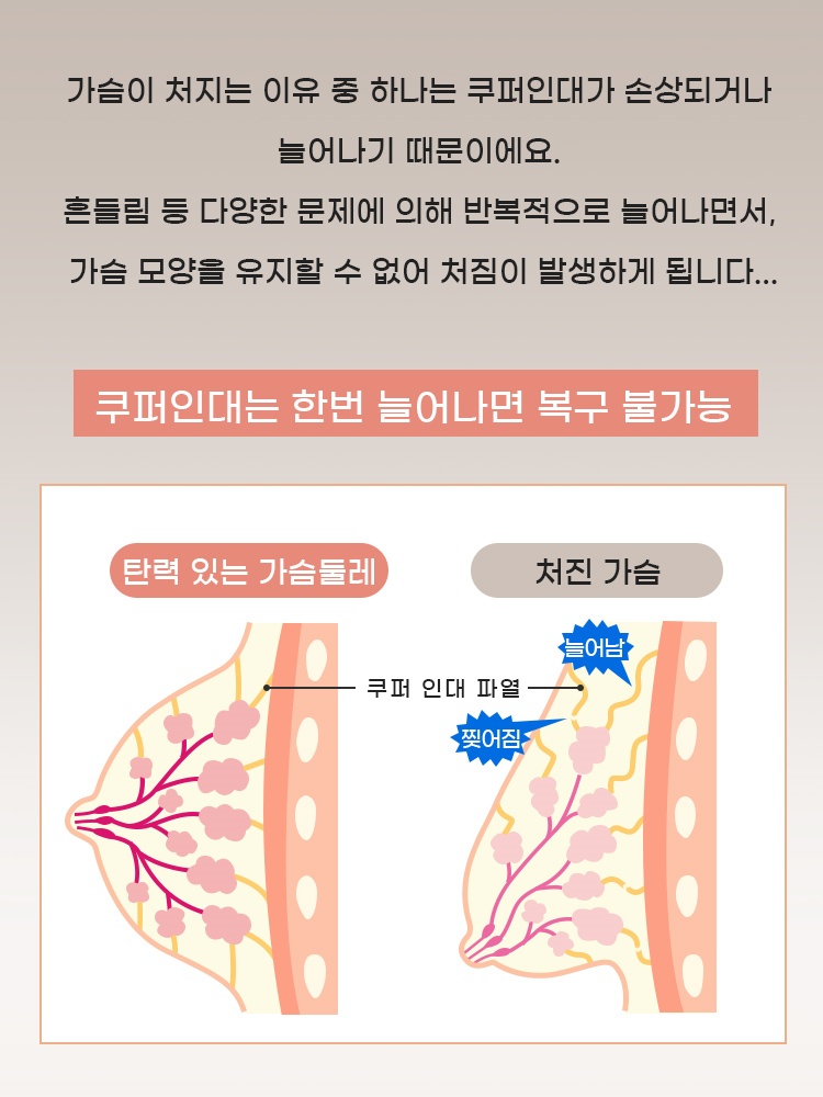 소프트 레이스 풀커버 미니마이저 브라 쿠퍼인대는 한번 늘어나면 복구 불가능 VEIMIA 베이미아
