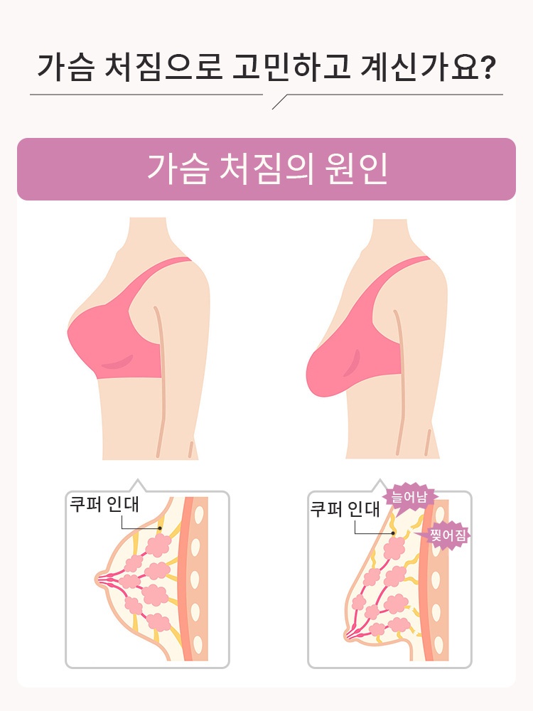 풀커버 자수 메쉬컵 미니마이저 브라 가슴 처짐으로 고민하고 계신가요 VEIMIA  베이미아