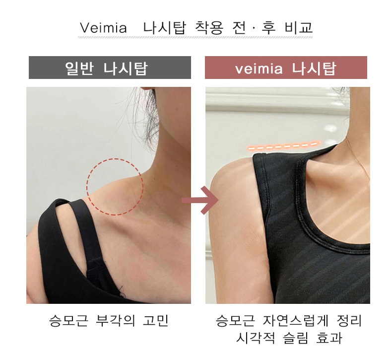 군살 거버 나시탑 착용 전 후 비교 VEIMIA