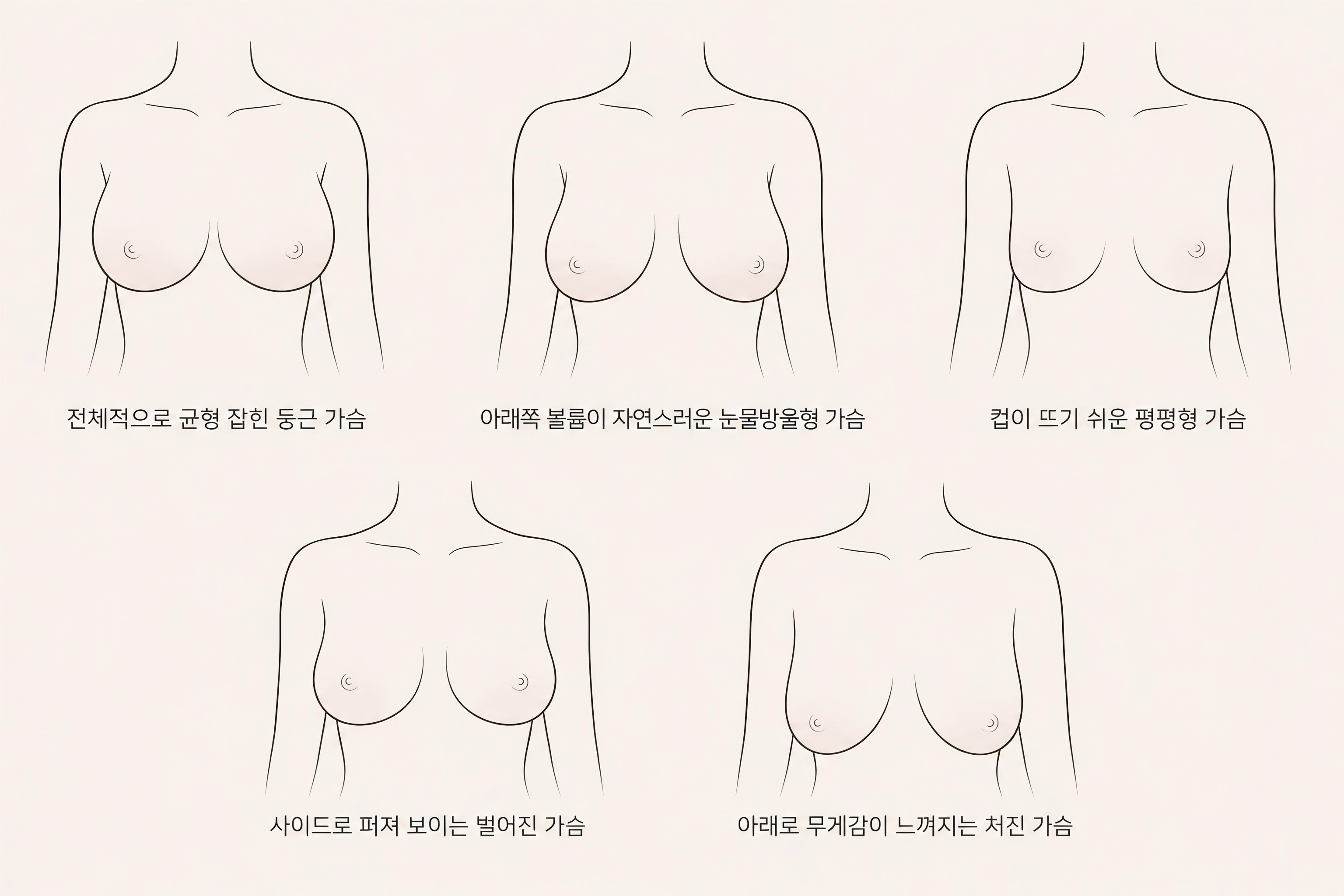 가슴 모양 종류별 정면 일러스트와 둥근 가슴, 눈물방울형, 평평형, 벌어진 가슴, 처진 가슴 비교