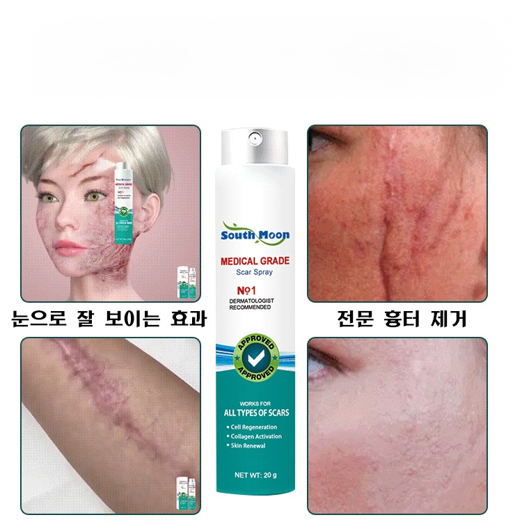 흉터 케어 미스트