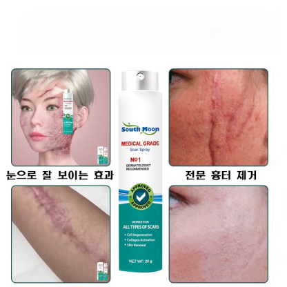 흉터 케어 미스트