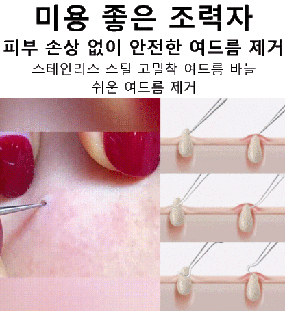 고정밀 고경도 세포 집게