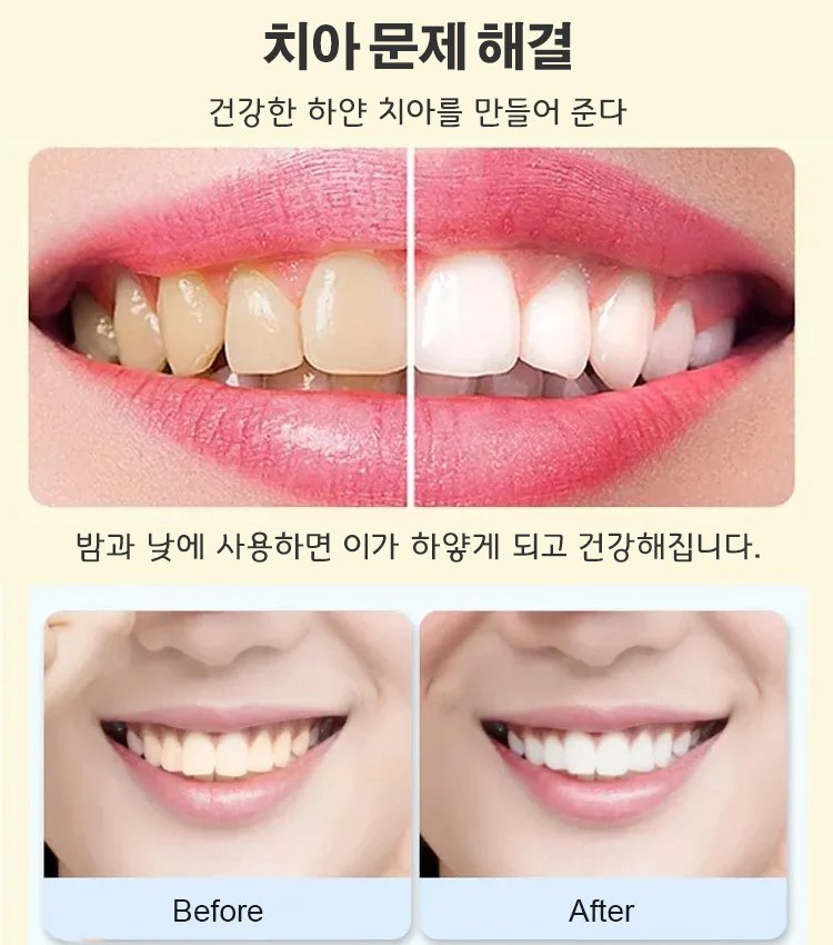 프로바이오틱 미백 치약