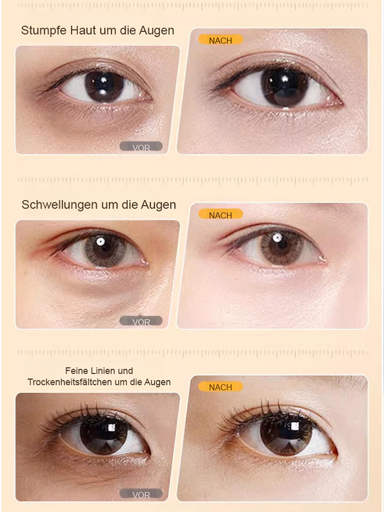 👩💝【Über 1 Million Mal verkauft】Augen SPA Lutein Straffungs Serumöl