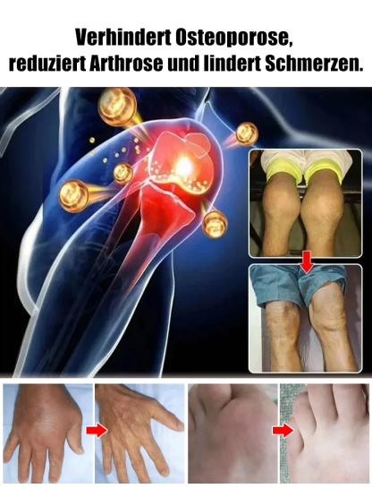 【100% Anwachsgarantie】 4J XXL Regina Süßkirschbaum | Kräftige 2-jährige Setzlinge 