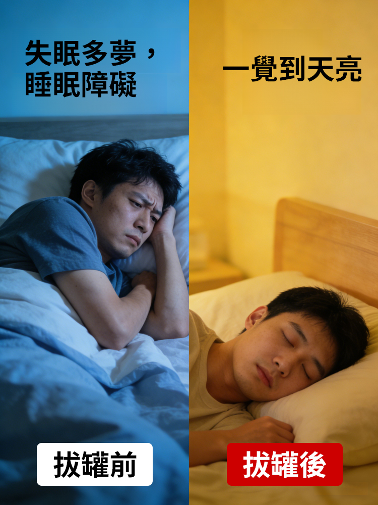 中醫養生真空拔罐器