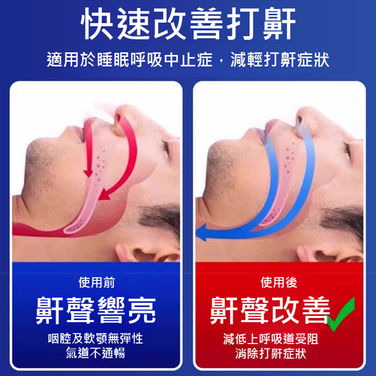 安秦寧通氣鼻貼