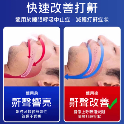 安秦寧通氣鼻貼