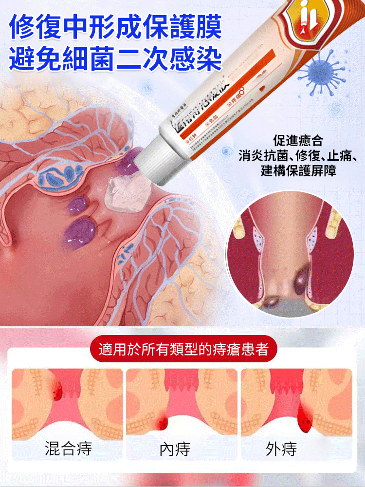 醫用痔瘡凝膠